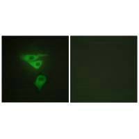 PDLIM1 Antibody
