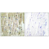 PDLIM1 Antibody