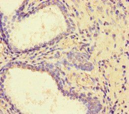 PDLIM5 Antibody