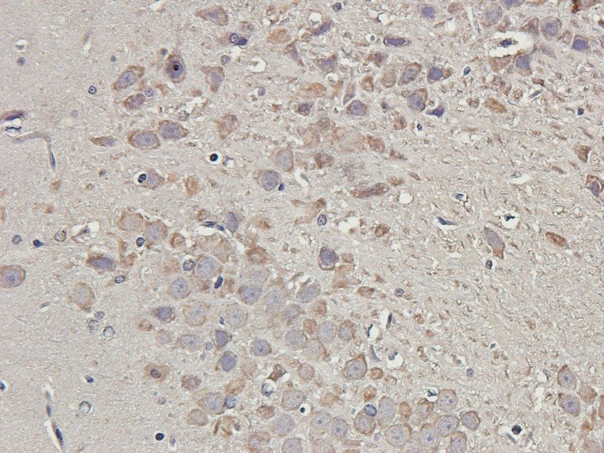PDS5A Rabbit Polyclonal Antibody