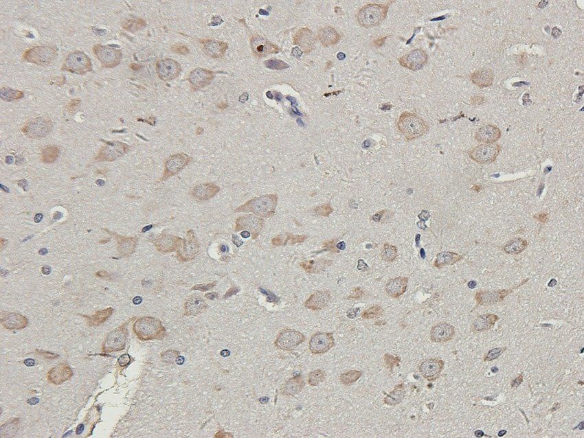 PDS5A Rabbit Polyclonal Antibody
