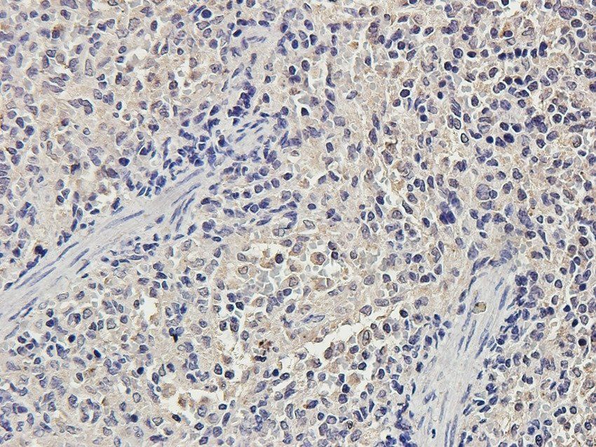 PDS5A Rabbit Polyclonal Antibody