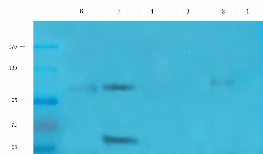 PDS5A Rabbit Polyclonal Antibody