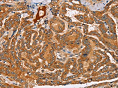 PEA15 Antibody