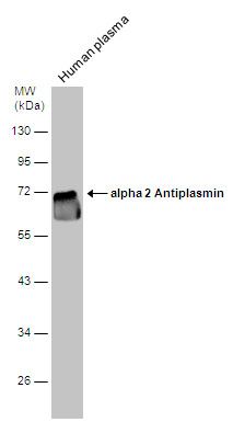 Alpha 2 Antiplasmin Rabbit Polyclonal Antibody