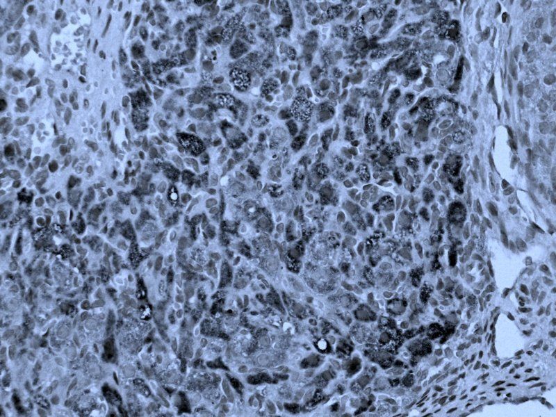 PEDF Rabbit Polyclonal Antibody