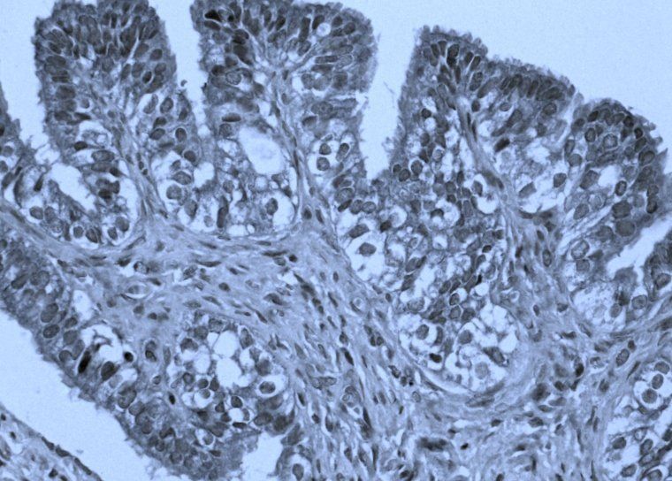 PEDF Rabbit Polyclonal Antibody