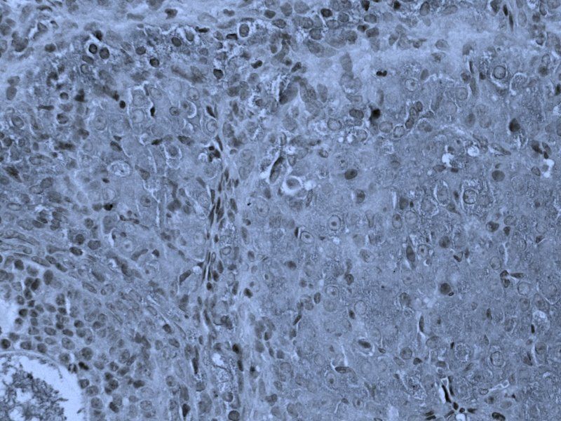 PEDF Rabbit Polyclonal Antibody