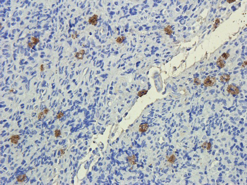 PEDF Mouse Monoclonal Antibody