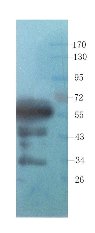 PEDF Mouse Monoclonal Antibody