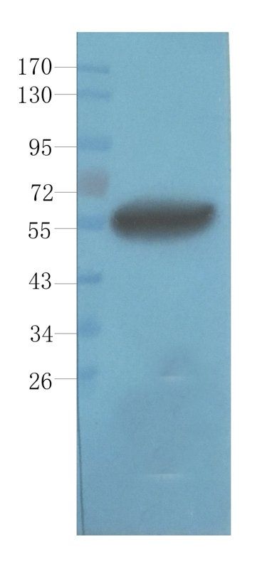 PEDF Mouse Monoclonal Antibody
