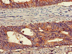 PEPD Antibody