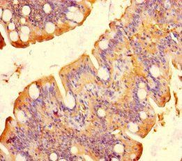 PYY Antibody