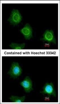 PF4V1 Rabbit Polyclonal Antibody