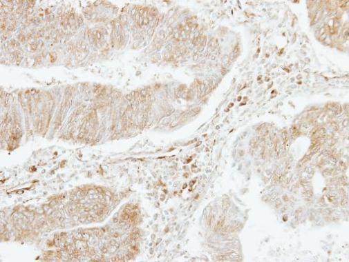 PF4V1 Rabbit Polyclonal Antibody
