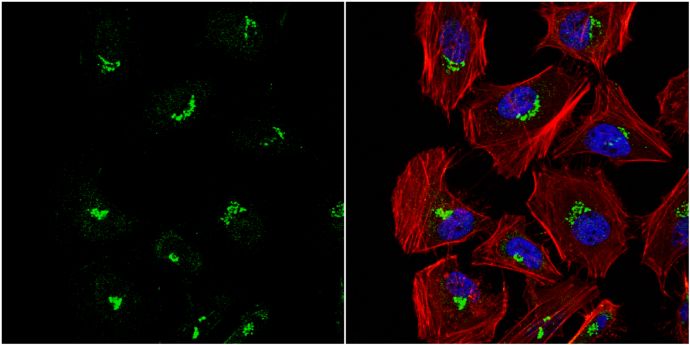 PFDN3 Rabbit Polyclonal Antibody
