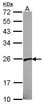 PFDN3 Rabbit Polyclonal Antibody