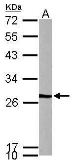 PFDN3 Rabbit Polyclonal Antibody