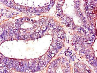 PFKM Antibody