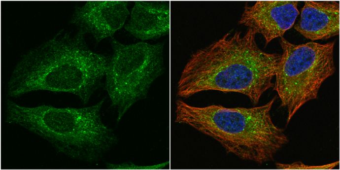 PGD Rabbit Polyclonal Antibody