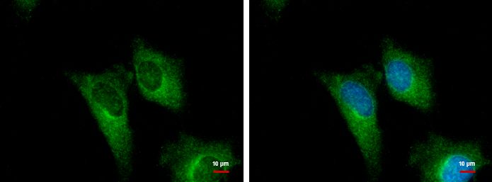 PGD Rabbit Polyclonal Antibody