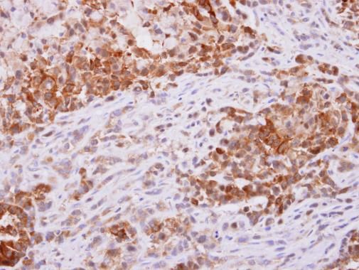 PGD Rabbit Polyclonal Antibody