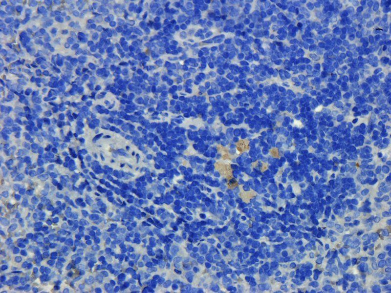 Prostaglandin E synthase 2 Rabbit Polyclonal Antibody