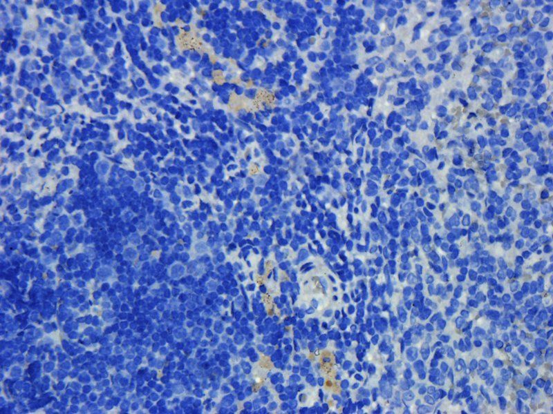 Prostaglandin E synthase 2 Rabbit Polyclonal Antibody