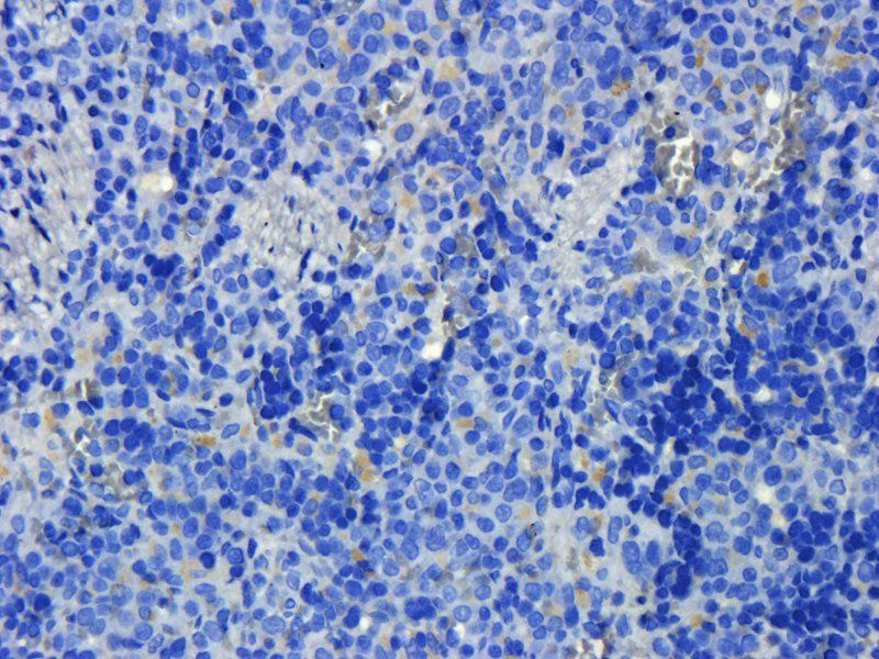 Prostaglandin E synthase 2 Rabbit Polyclonal Antibody
