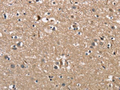 PGK1 Antibody