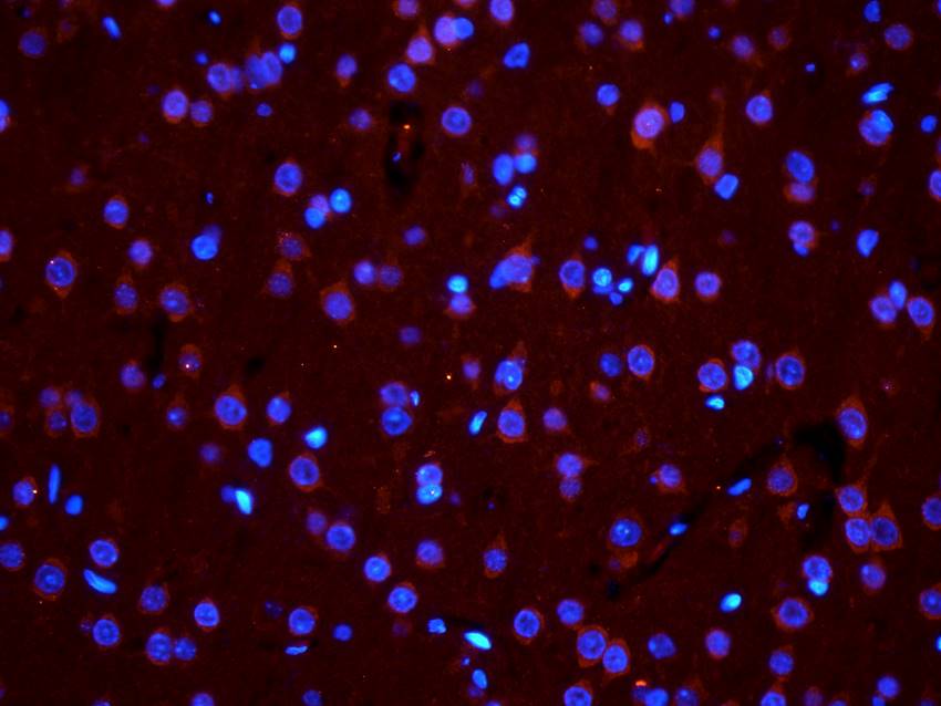 PGP9.5 Rabbit Polyclonal Antibody