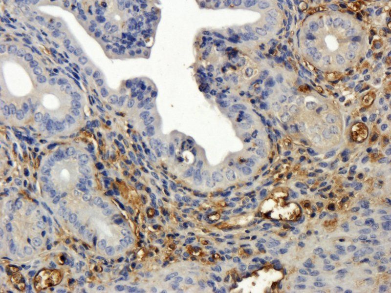 PHEX Rabbit Polyclonal Antibody