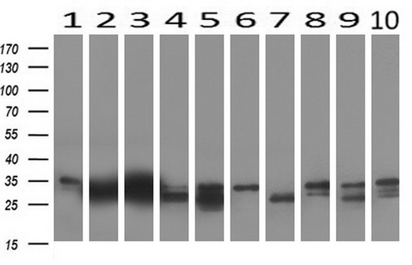 PHLDA1 Antibody