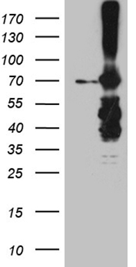 PHLDA1 Antibody