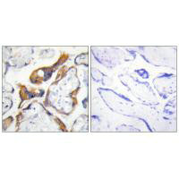 PHLDA2 Antibody