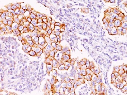 Phosphotyrosine (P-Tyr) Antibody
