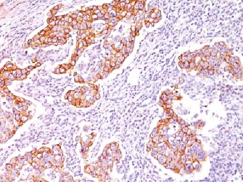 Phosphotyrosine (P-Tyr) Antibody
