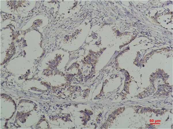 Phosphotyrosine Antibody