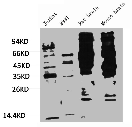 Phosphotyrosine Antibody