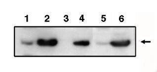 Rabbit anti Human PIG3 (p53 inducible gene 3) Antibody