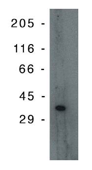Mouse anti Human PIG3 (p53 inducible gene 3) Antibody