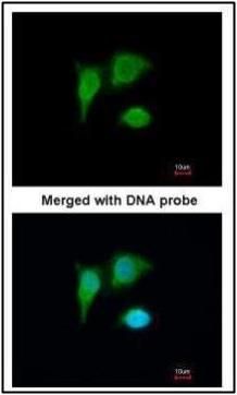 PIG3 Rabbit Polyclonal Antibody