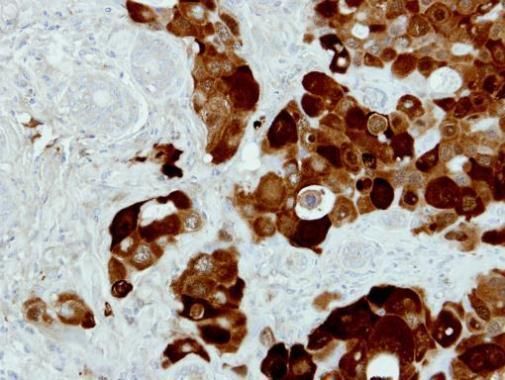 PIG3 Rabbit Polyclonal Antibody