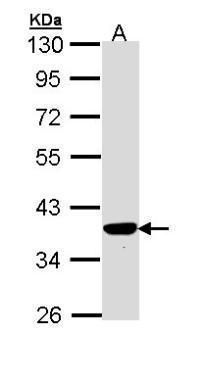 PIG3 Rabbit Polyclonal Antibody
