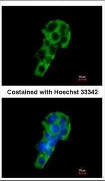 PIGR Rabbit Polyclonal Antibody
