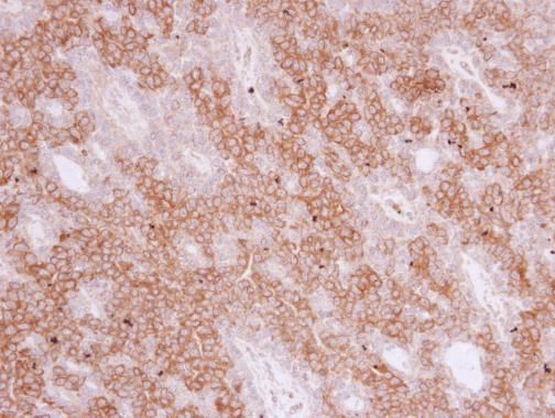PIGR Rabbit Polyclonal Antibody