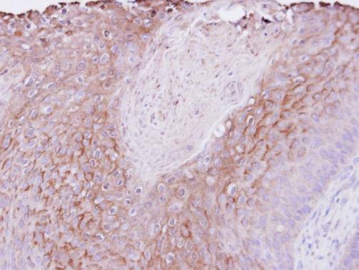 PIGR Rabbit Polyclonal Antibody