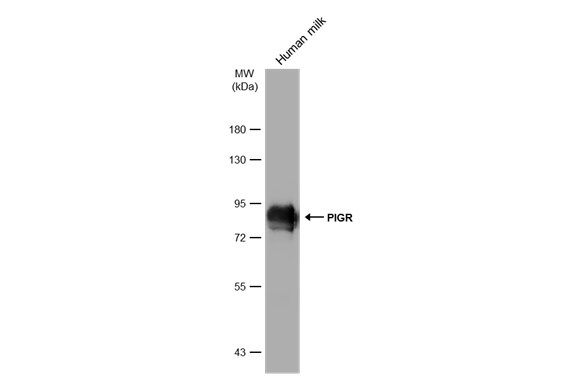 PIGR Rabbit Polyclonal Antibody