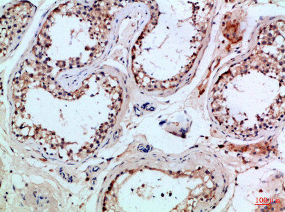 PIK3R2 Antibody