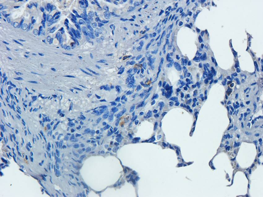 PIM1 Rabbit Polyclonal Antibody